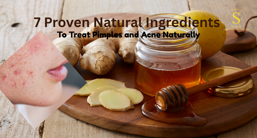 Natural Ingredients to Treat Pimples and Acne Naturally