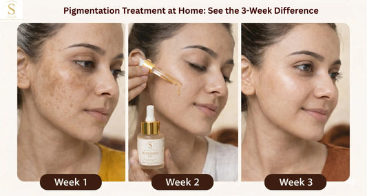 Effective and Best Treatment for Pigmentation on Face at Home