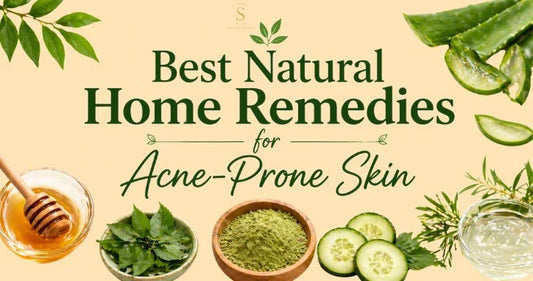 Best Natural Home Remedies for Acne-Prone Skin