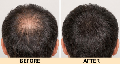 Advanced Hair Growth Serum | Powered by Rosemary, Moringa & Amla to strengthen every strand